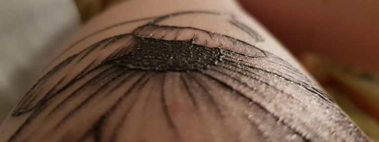 How to Fix A Raised Tattoo: 6 Possible Causes and Effective Treatment